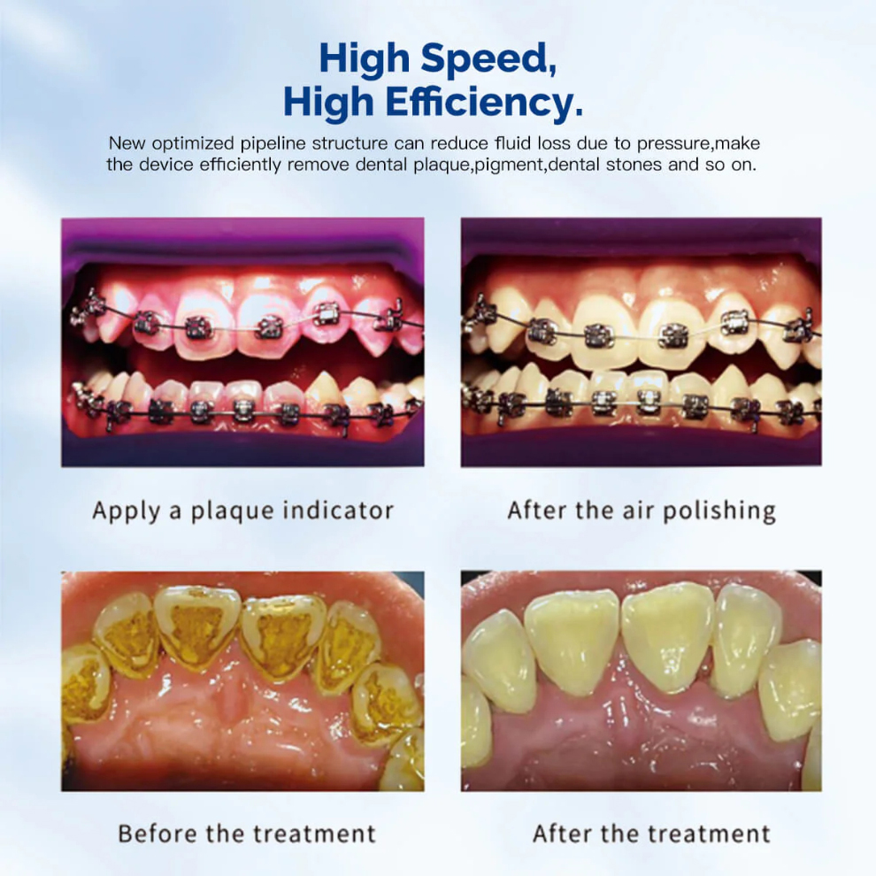 VRN® DQ-40 Skaler ultradzwiękowy z piaskarką do skalingu endodontycznego przyzębia